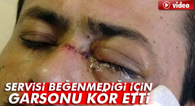 Adıyaman da servisi beğenmediği için garsonu kör etti
